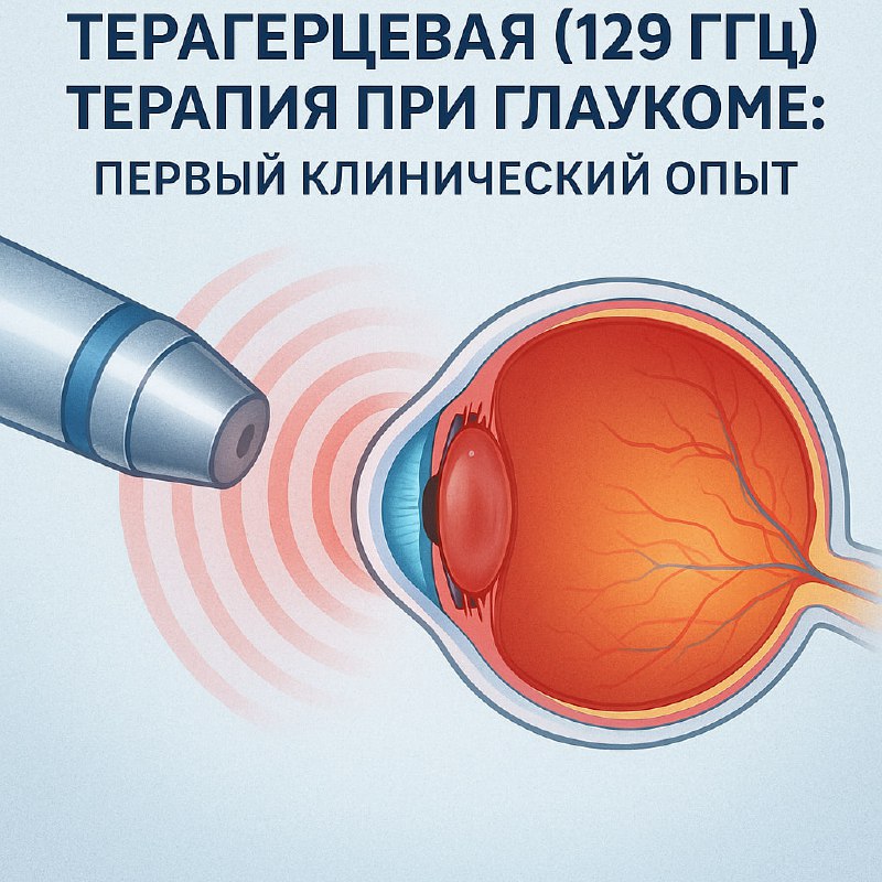 Терагерцевая терапия 129 ГГц при глаукоме: первый клинический опыт